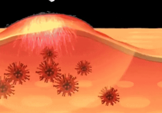 181558343317.gif