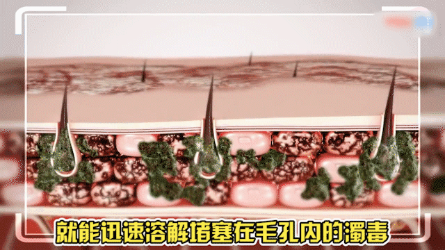 181558364401.gif